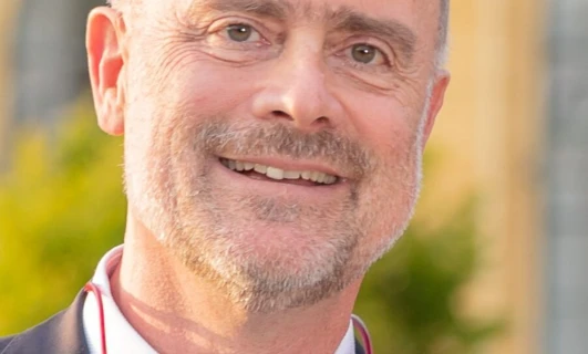 A close-up of a person's face with a big smile, chin resting on their hand, showing happiness and wrinkles on their forehead.